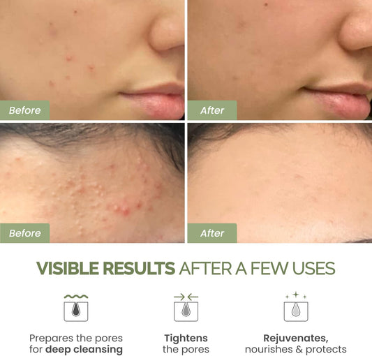 Plantifique Korean Skincare Face Mask – Organic Clay Mask with Avocado & Green Tea, Vegan & Dermatologically Tested Mud Mask for Face & Body – 100g/3.4 Oz